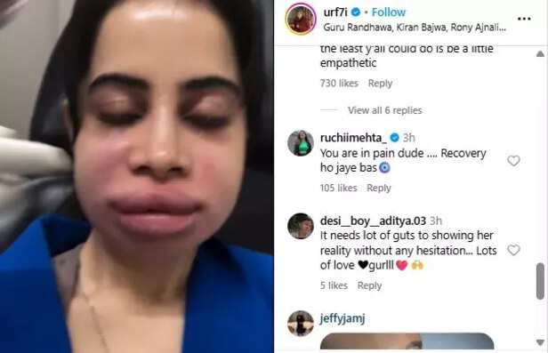 Uorfi Javed on filler rem