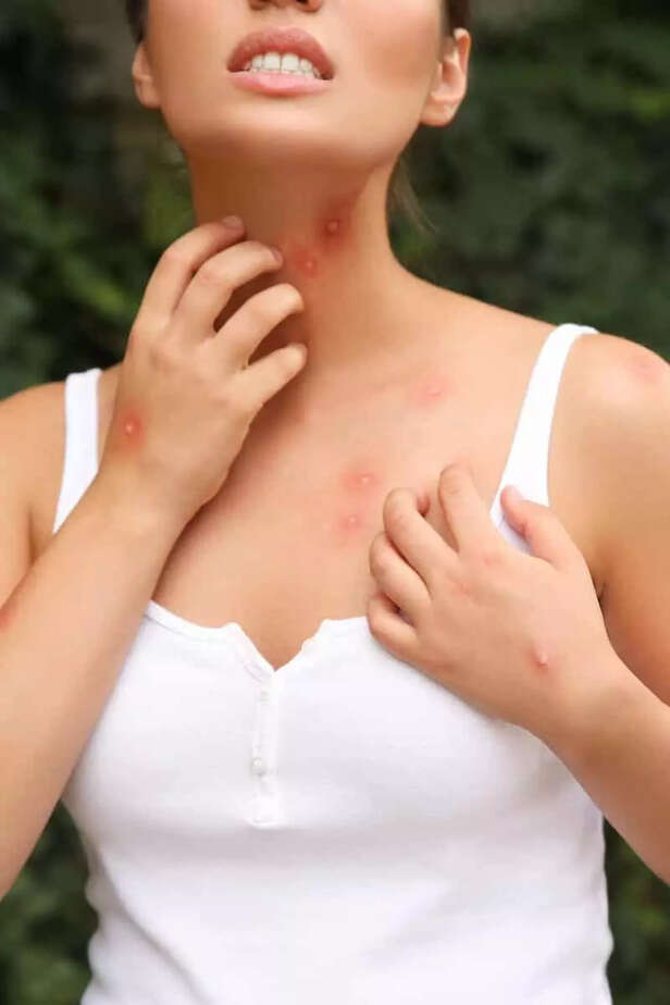 CDC issues urgent travel